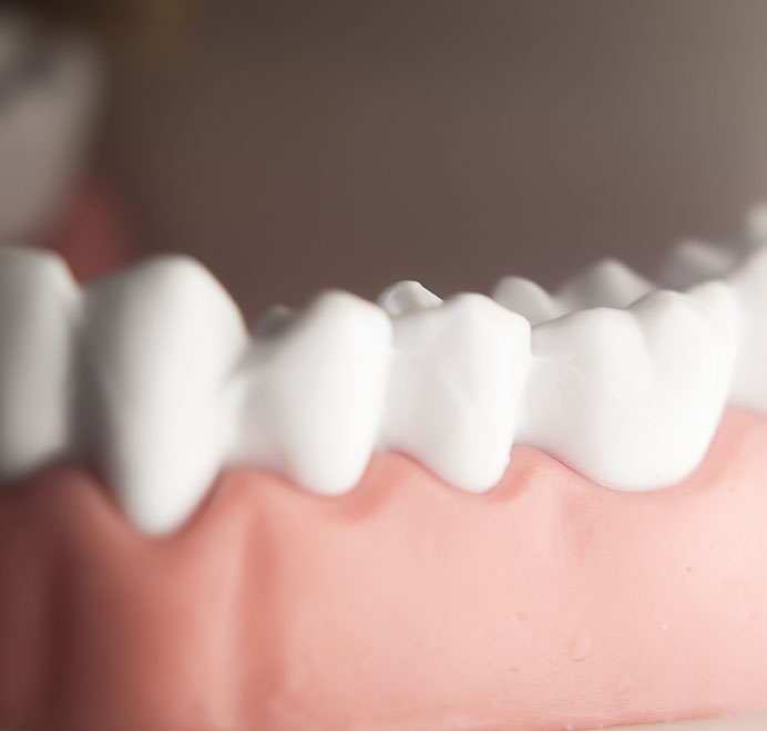 歯周外科手術・歯周組織の再生療法